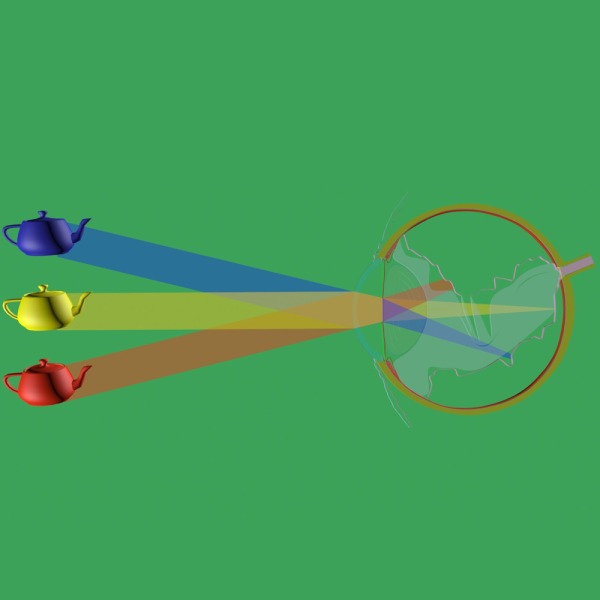 desprendimiento de retina iogs madrid barcelona